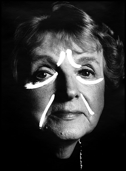 Diane Botox Lines